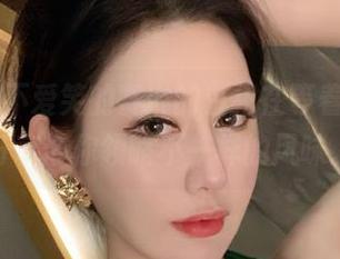 微密圈 – 不爱笑的赛琳的白裙在等着你，图包分享带你领略不一样的风味。